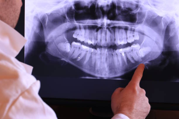 Best Emergency Cosmetic Dentistry in Yarmouth Port, MA