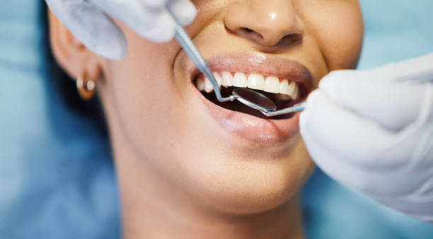 Best Emergency Dental Care for Abscessed Tooth in Yarmouth Port, MA